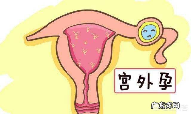 为什么有些人会发生宫外孕的情况?应该怎么办?
