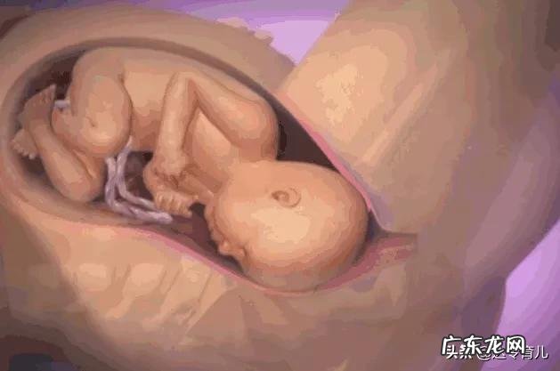 胎儿未入盆是否会影响顺产？