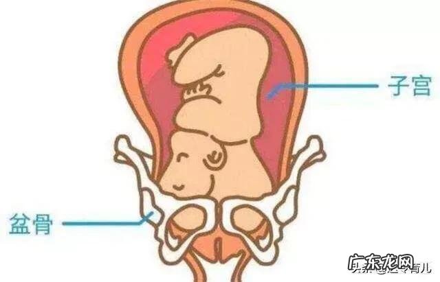 胎儿未入盆是否会影响顺产？