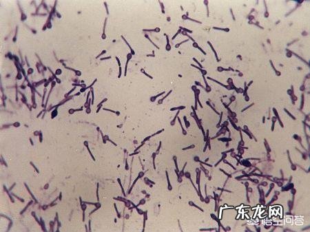 什么情况下一定要打破伤风?