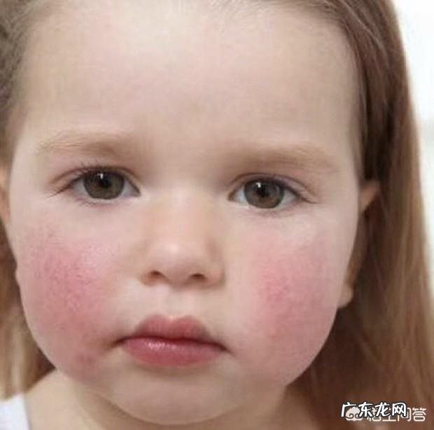 春天该如何护理皮肤呢?