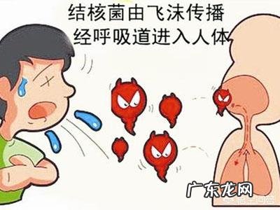 肺结核会传染吗?