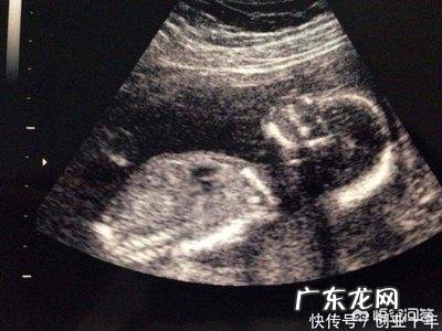 为什么有人说受精卵着床会有感冒的症状,有的却说什么感觉也没有?