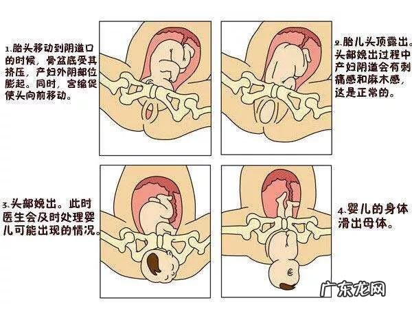 有规律宫缩是开宫口吗?