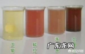 肾功能不好的人都有哪些表现?