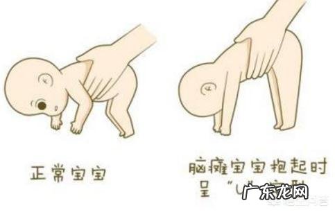 新生儿能够发现是不是脑瘫吗?