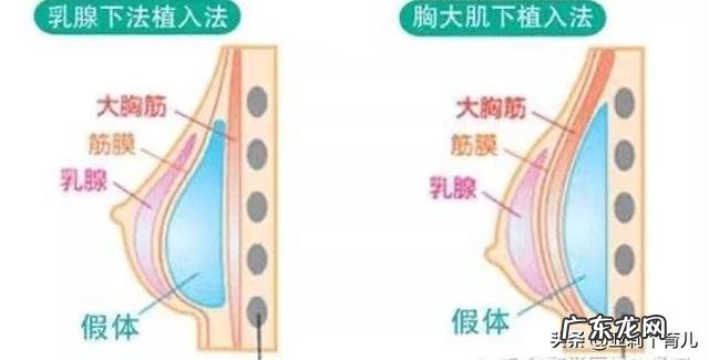 平胸的女人生育后如何哺育孩子?