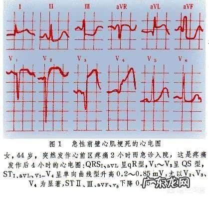 心电图异常就是有心脏病吗？