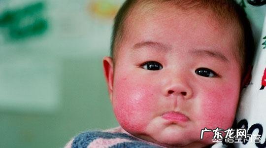 宝宝长奶癣是因为喝奶引起的吗?应该怎么办?