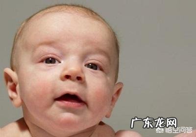 宝宝长奶癣是因为喝奶引起的吗?应该怎么办?