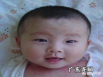 宝宝长奶癣是因为喝奶引起的吗?应该怎么办?