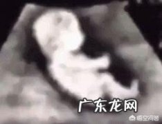 胎儿缺氧的后果这么严重，怎么才能知道胎儿有没有缺氧呢？