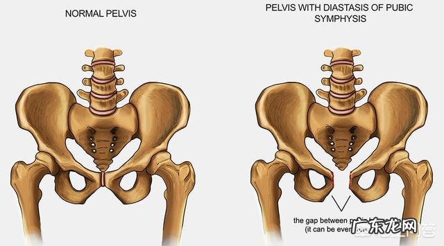 孕晚期耻骨联合疼怎么办?