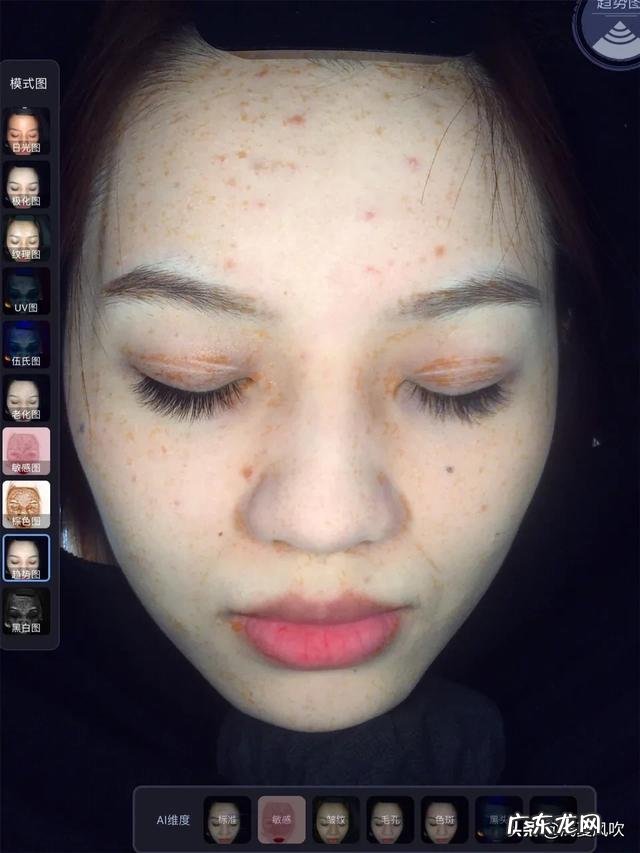 痘痘肌的如何日常护理,才不会反复爆痘?