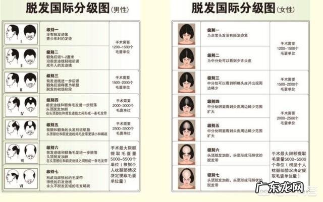 为什么只有男性会严重脱发?