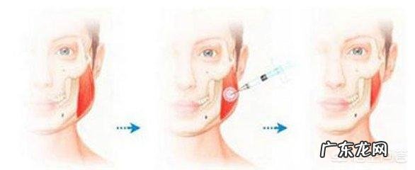 打瘦脸针的危害有哪些?