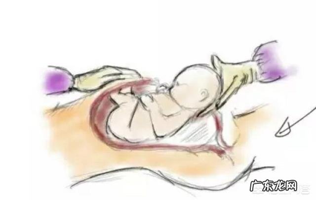 孕几周的时候进行剖宫产手术比较好?