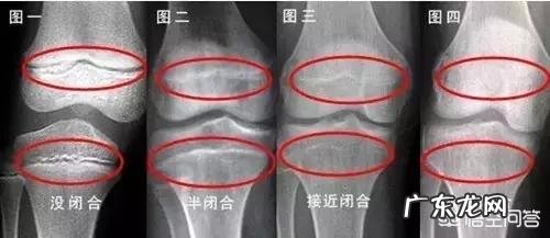 孩子在什么年龄段会停止长高?有哪些注意事项?