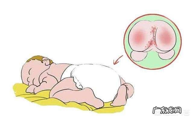 宝宝为什么会红屁股，该怎么解决？