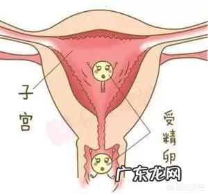 生化妊娠后需要做月子吗?