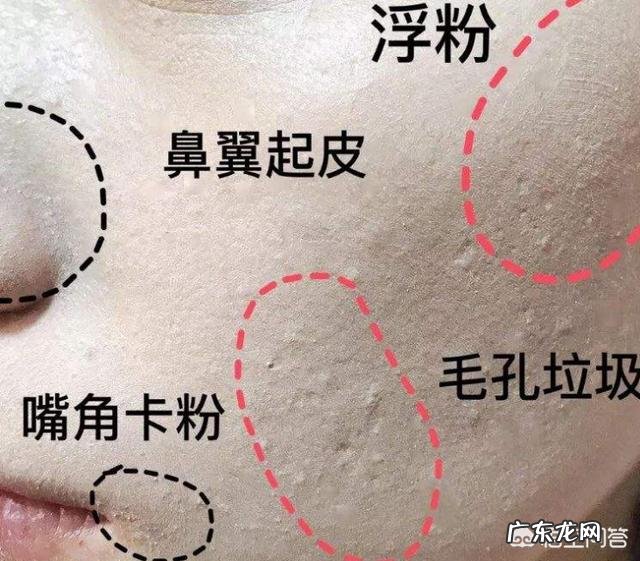 化妆用再好的护肤和粉底都会浮粉,各种防卡粉的方法都试了还是卡,有什么好办法吗?