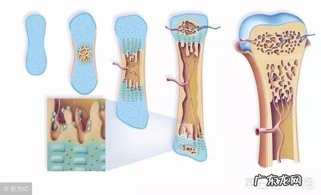 青少年出现什么特征就不长高了?