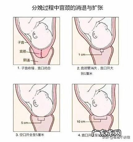 宫口开5指，产妇打催产素有副作用吗？