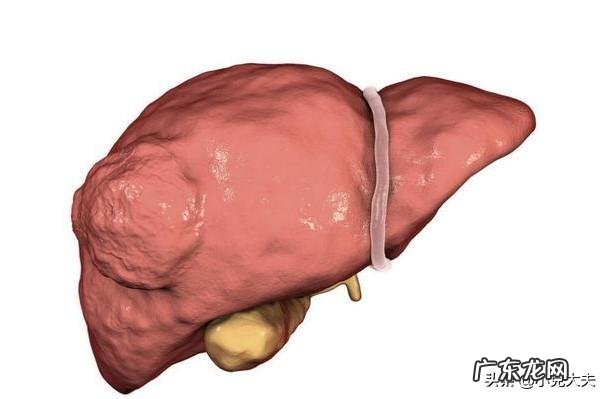肝开始癌变时,脚底会有3个迹象,若一个不占,肝癌离你还很远!迹象是什么?