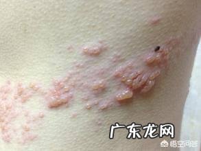 肝开始癌变时，脚底会有3个迹象，若一个不占，肝癌离你还很远！迹象是什么？