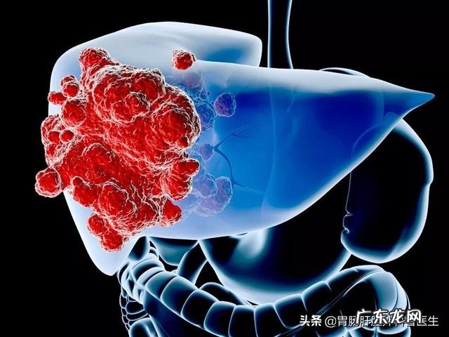 肝开始癌变时,脚底会有3个迹象,若一个不占,肝癌离你还很远!迹象是什么?