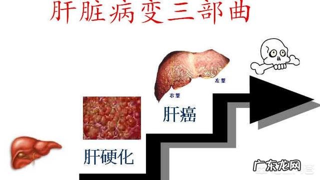 肝开始癌变时，脚底会有3个迹象，若一个不占，肝癌离你还很远！迹象是什么？