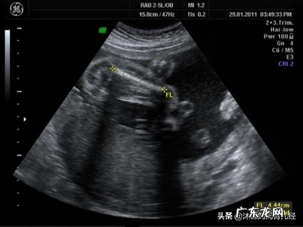 怀孕四十天孕囊有多大?需注意什么?