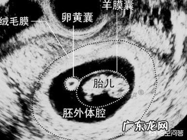 怀孕四十天孕囊有多大?需注意什么?