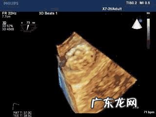 怀孕四十天孕囊有多大?需注意什么?