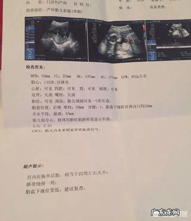 胎盘低是怎么回事?该怎么办?