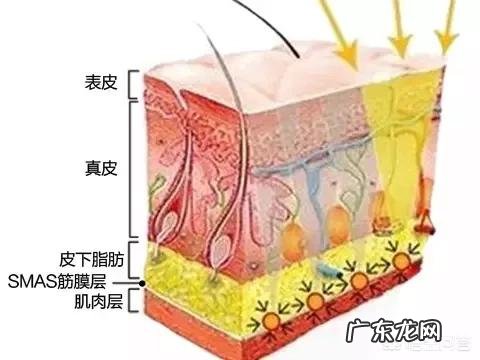 面部印第安纹应该怎么去除?