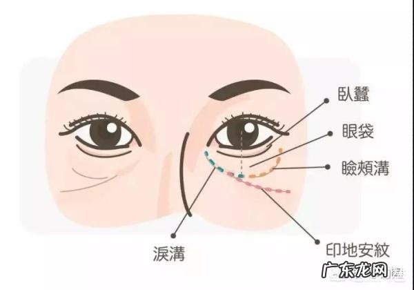 面部印第安纹应该怎么去除?