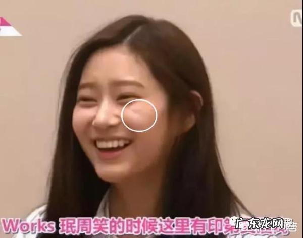 面部印第安纹应该怎么去除?