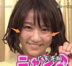 面部印第安纹应该怎么去除?