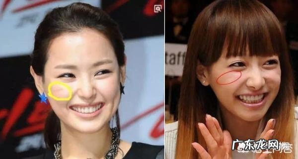 面部印第安纹应该怎么去除?