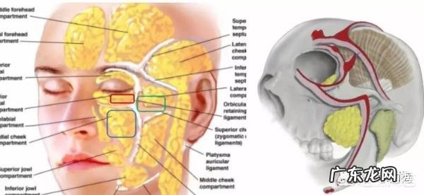 面部印第安纹应该怎么去除?