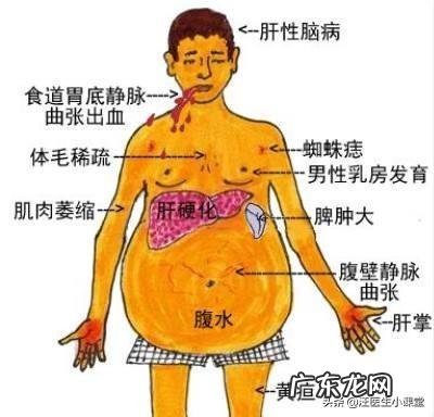 肝不好会有什么临床表现?