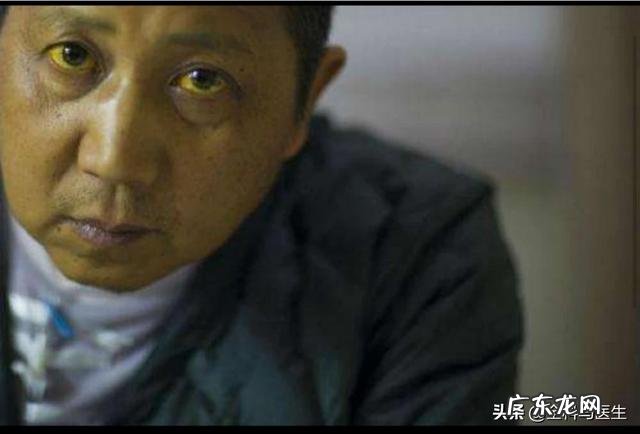 肝不好会有什么临床表现?