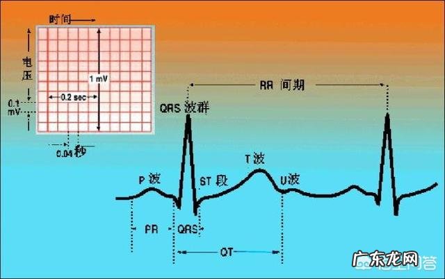 心电图ST段改变,有什么临床意义?