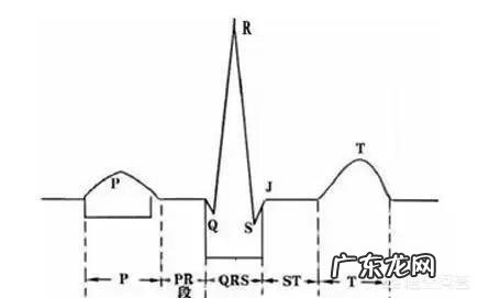心电图ST段改变,有什么临床意义?