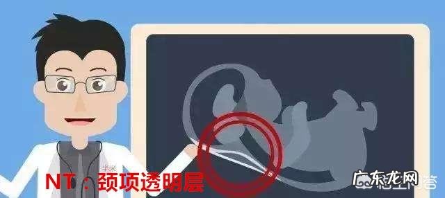 胎儿NT检查3、6意味着什么?