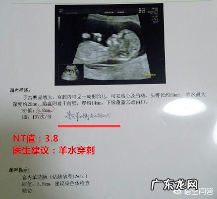 胎儿NT检查3、6意味着什么?