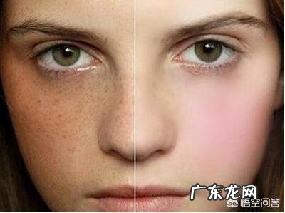 去除色斑黄褐斑你有哪些妙招？