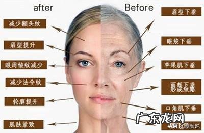 25周岁,额头皮肤越来越松弛,还有抬头纹,怎么回事?如何改善?