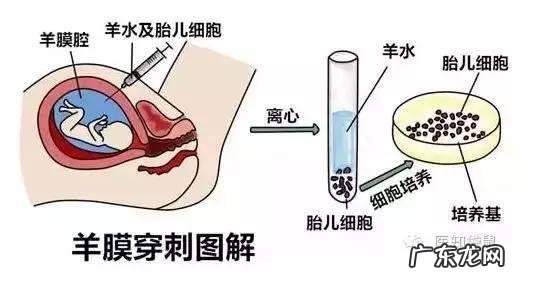 准妈妈发现羊水过少该如何应对？